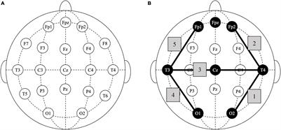 Use of Novel Concussion Protocol With Infralow Frequency Neuromodulation Demonstrates Significant Treatment Response in Patients With Persistent Postconcussion Symptoms, a Retrospective Study